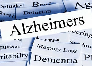 African plant extract could treat Alzheimer's disease