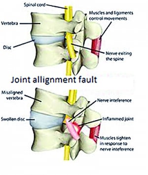 Docyard | Osteopathy a growing strain