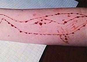 Blue Whale: Delhi HC expresses concern over childrens' suicide