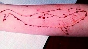 Teen follows Blue Whale, jumps off 4th floor, critical