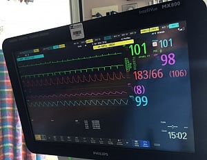 New sensor may help doctors remotely monitor patient progress