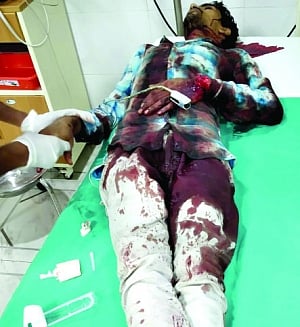 Bikers hack Rly guard’s hands for not opening crossing gate