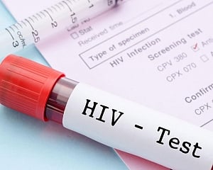 China HIV/AIDS cases surge by 14 pc