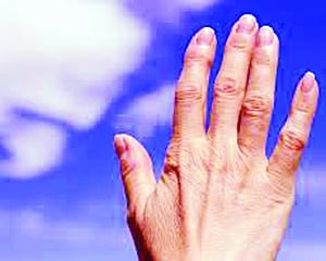 How to beat Arthritis