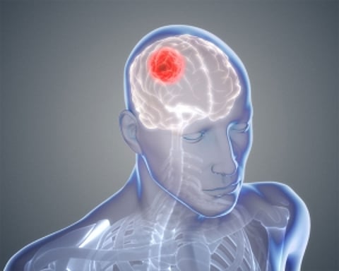 New drug shows promise in halting spread of brain cancer
