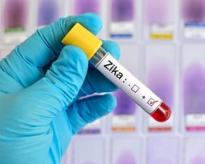 No need to panic, Zika outbreak under control: Health Ministry
