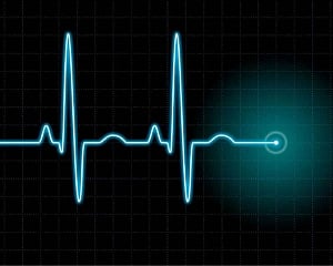 Computer tool predicts risk of deadly irregular heart beats