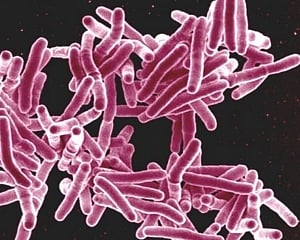 Indian firm develops test to detect drug-resistant TB mutation