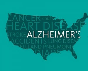 Lack of cleaning in brain cells causes Alzheimer's: Study