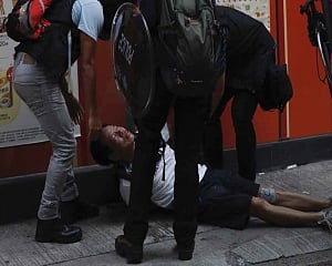 Police shoot protester in Hong Kong with live round