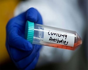 Antibodies of cured younger lot may help in treating Covid-19