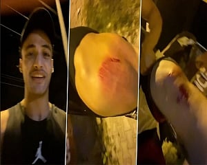 Asim Riaz attacked while cyling, sustains multiple injuries