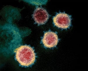 COVID-19 virus may hijack our cells' cholesterol system to spread through body: Study