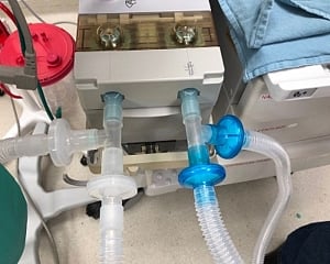 Do we need new ventilator protocol to treat COVID-19 in India?