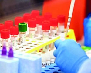 Genome sequencing for 5% of +ve cases amid UK strain fear