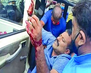 Gold smuggling racket: UAE Consulate attache gunman tries to kill self