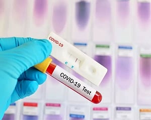 Mylab increases production capacity to 2 lakh tests per day for Covid-19