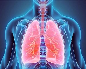 Non-smokers with COPD at higher risk of lung cancer: Study