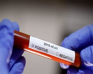 Six fresh coronavirus cases in Himachal; total count 663
