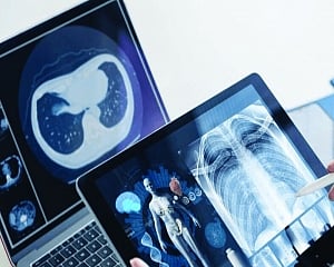 Time to fight tobacco use with telemedicine
