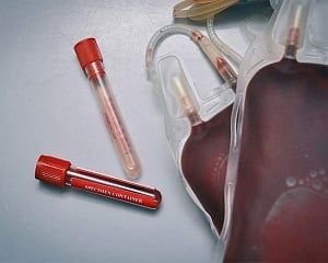 What is convalescent plasma therapy against COVID-19