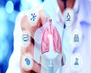 Dockyard : Lung cancer in never-smokers