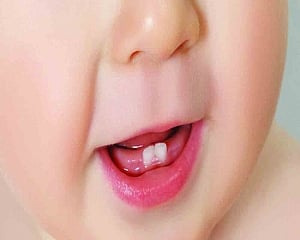 Docyard | Teeth talk