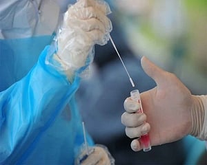 Likely order of Covid symptoms depends on coronavirus variant: Study