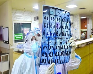 Lungs more vulnerable to Delta Plus