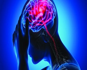 Mini stroke vs regular stroke