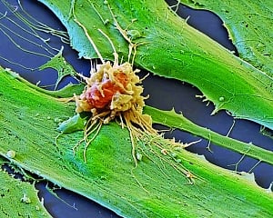 Cancer treatments boosted by immune-cell hacking