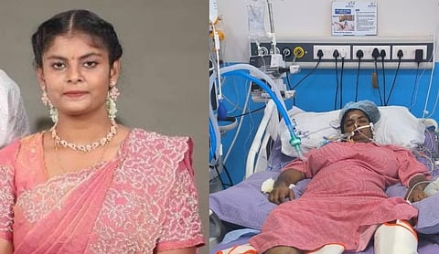 Representational image: A patient before and after treatment.