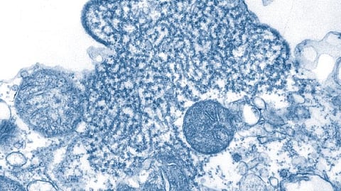 Nipah alert in West Bengal