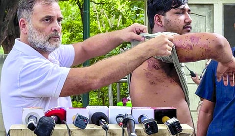 RAF fired pellets at July 20 protests, notes Delhi police diary
