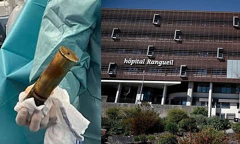 ஆசன வாயில் வெடிகுண்டுடன் வந்த நபர்..பயத்தில் அலறி அடித்து ஓடிய நோயாளிகள்