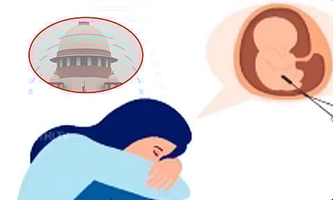 "கருவை சுமக்க பெண்ணுக்கு உத்தரவிட முடியாது" - 30 வார கருவை கலைக்க கோர்ட்டு அனுமதி