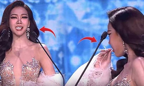 அழகி போட்டியில் திடீரென கழன்று வந்த பல்: உண்மையான அழகி நீங்கள்தான் என புகழாரம்