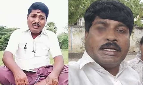 யூடியூபர் ஜி.பி.முத்து மீது தாக்குதல் - ரத்த காயத்துடன் வீடியோ வெளியிட்டதால் பரபரப்பு