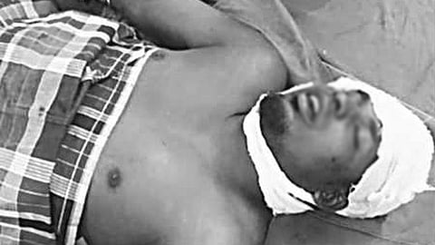 வாலிபால் விளையாட்டின்போது நடந்த தகராறில் முன்விரோதம்.. வாலிபர் மீது சரமாரி தாக்குதல்