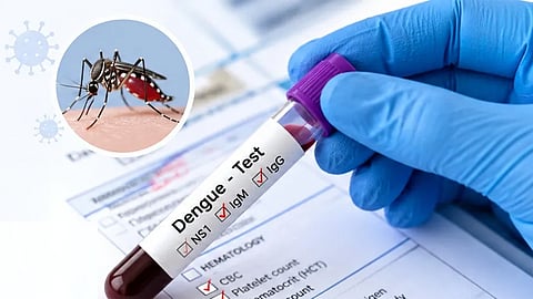 மழை இல்லாத நிலையிலும் டெங்கு காய்ச்சல் பரவுவது ஏன்? - நிபுணர்கள் அதிர்ச்சி தகவல்