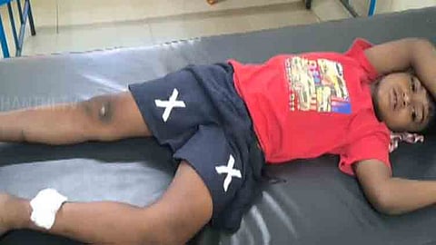 திருவாரூரில் 10-க்கும் மேற்பட்டோரை கடித்த தெரு நாய்கள்... பொதுமக்கள் பீதி!