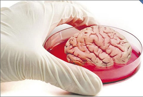 ரத்த நாளம் கொண்ட ‘மினி’ மனித மூளைகள்!