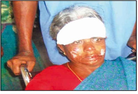 சங்கரன்கோவில் அருகே பெண்ணை தாக்கி சங்கிலி பறிக்க முயற்சி