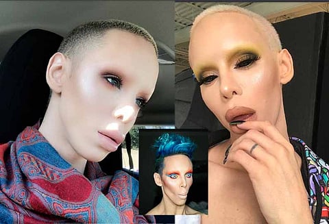 பிறப்புறுப்பு மற்றும் தொப்புள்ளை நீக்கி வேற்றுகிரகவாசி போல் மாறிய வாலிபர்