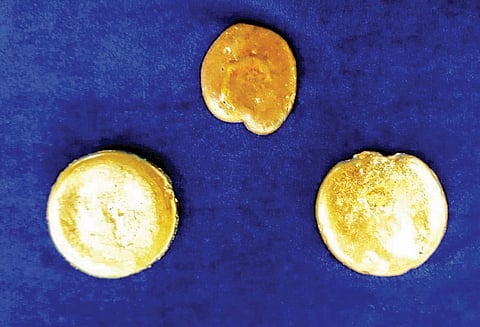 சென்னைக்கு நூதன முறையில் ரூ.20 லட்சம் தங்கம் கடத்தல் வாலிபர் கைது