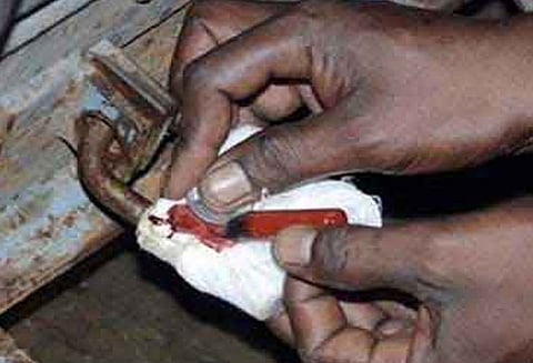 முதியவரின் பற்களைப் பிடுங்கிய ஆஸ்பத்திரிக்கு சீல் வைப்பு