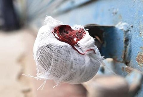 மொடக்குறிச்சி அருகே முறைகேடாக ரசாயன பொருள் பயன்படுத்திய 5 கரும்பாலைகளுக்கு ‘சீல்’ - அதிகாரிகள் நடவடிக்கை