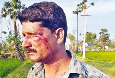 வேதாரண்யம் அருகே சப்-இன்ஸ்பெக்டர் மீது தாக்குதல் 2 பேருக்கு வலைவீச்சு