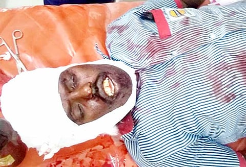 புதுச்சத்திரம் பெட்ரோல் ‘பங்க்’கில் ஊழியரை அரிவாளால் வெட்டி பணப்பை பறிப்பு - மோட்டார் சைக்கிளில் வந்த 3 பேருக்கு வலைவீச்சு