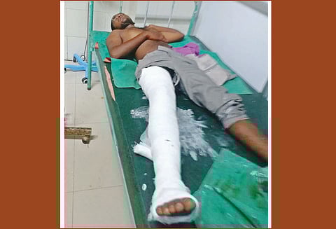 போலீசார் பிடிக்க முயன்ற போது மலையில் இருந்து குதித்த கொள்ளையன் கால் முறிந்தது